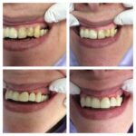 Best smile makeover dentist in Banashankari