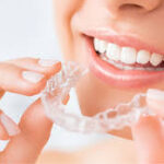 best quality braces and aligners