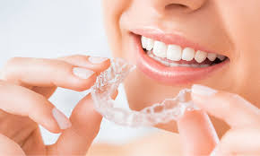 best quality braces and aligners