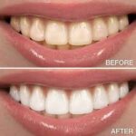 Best smile makeover dentist in Banashankari