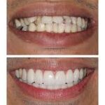 cosmetic dentistry image