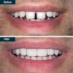 Best smile makeover dentist in Banashankari