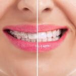 Best smile makeover dentist in Banashankari