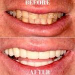 Best smile makeover dentist in Banashankari