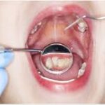 kids dental clinic in Banashankari