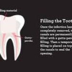 Best dental filling in Banashankari